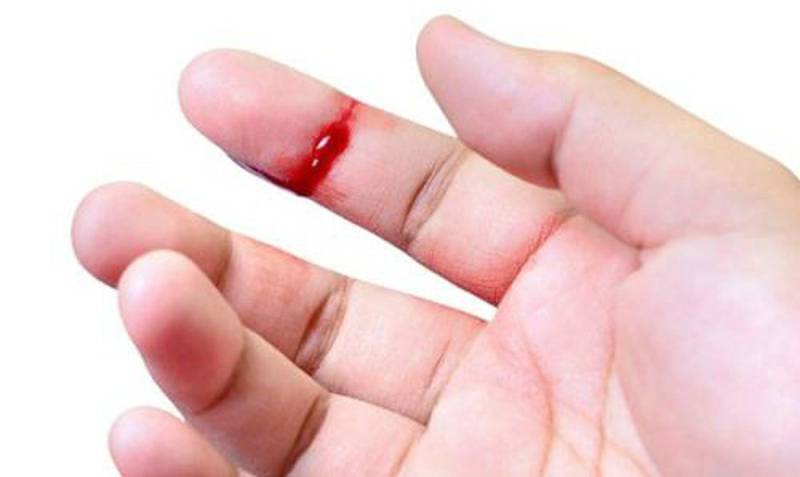 Mơ Thấy Bàn Tay Đánh Con Gì Để Phát Tài 3 Mơ thấy ngón tay bị đứt