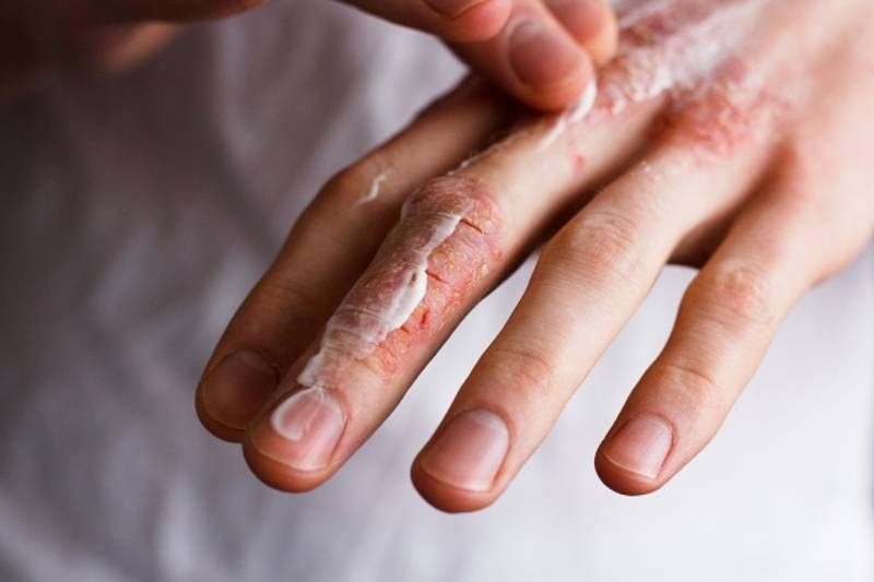 Mơ Thấy Bàn Tay Đánh Con Gì Để Phát Tài 5 Mơ thấy tay bị đứt khi làm việc