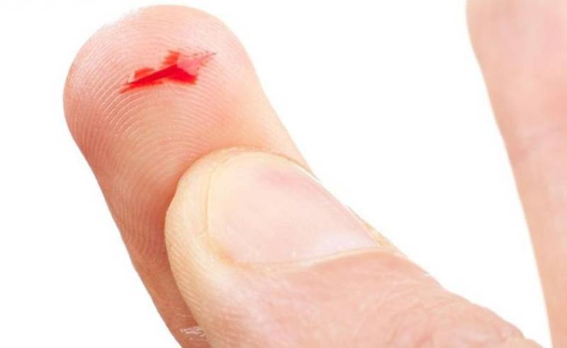 Mơ Thấy Bàn Tay Đánh Con Gì Để Phát Tài 4 Mơ thấy tay chảy máu nhiều